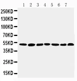 Anti-C-terminaal-bindend eiwit 1 CtBP1 Antibody Picoband®