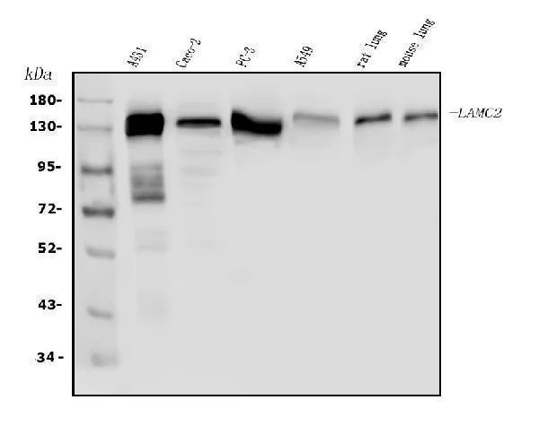 Anti-Lamine subunit gamma-2 LAMC2 Antibody Picoband®