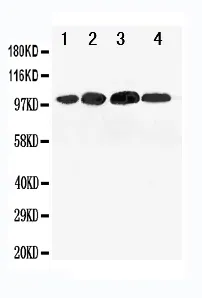 Anti-Mineralocorticoid Receptor/NR3C2 Antibody Picoband®