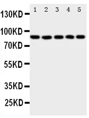 Anti-5 Lipoxygenase/ALOX5 Antibody Picoband®