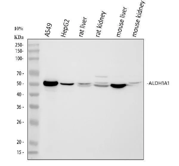 Antiretinadehydrogenase 1 ALDH1A1 Antibody Picoband®