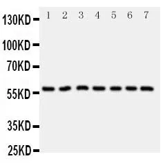 Anti-CYP11B1 Antibody Picoband®