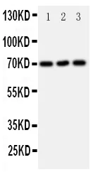 Antiserotoninetransporter/SLC6A4 Antibody Picoband®
