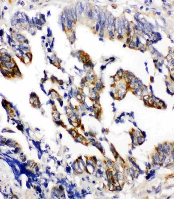 Anti-Beta Arrestin 2/ARRB2 Antibody Picoband®