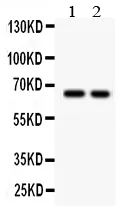 Anti-TGF beta receptor II/TGFBR2 Antibody Picoband®