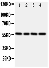 Anti-TXNRD2 Antibody Picoband®