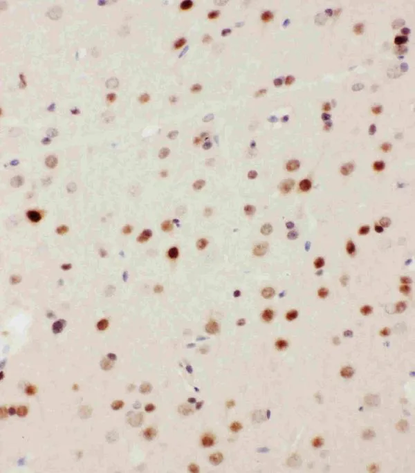 Anti-MEKK3/MAP3K3 Antibody Picoband®