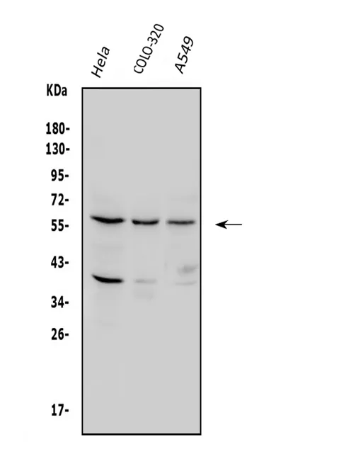 Anti-SQSTM1/p62 Antibody Picoband®