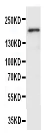 Anti-VEGF Receptor 2/KDR Antibody Picoband®