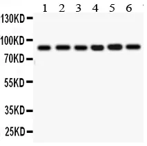Anti-IKK bèta/IKBKB Antibody Picoband®