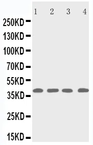 Anti-p53R2/RRM2B Antilichaam Picoband®