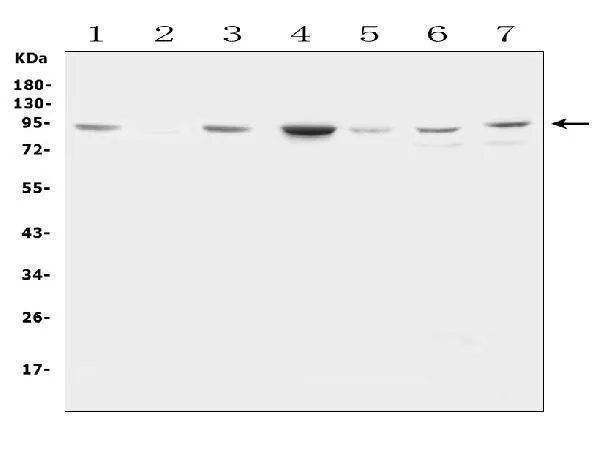 Anti-Factor VIII/F8 Antibody Picoband®