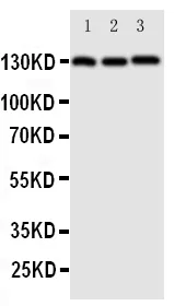 Anti-VE-Cadherin CDH5-Antibody Picoband®