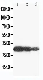 Anti-Aquaporine 6/AQP6 Antibody Picoband®