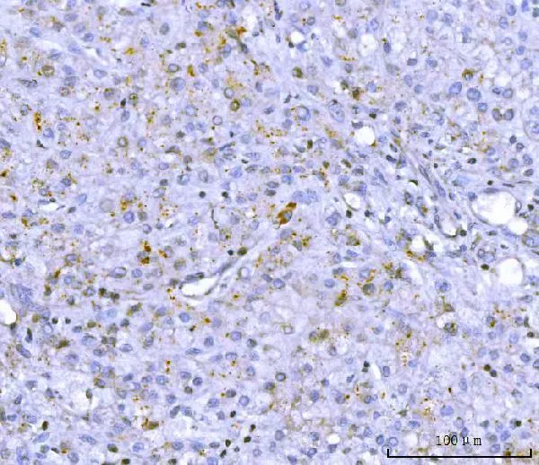 Anti-PCSK9 Antibody Picoband®