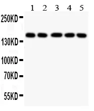 Anti-Collagen II/COL2A1 Antibody Picoband®
