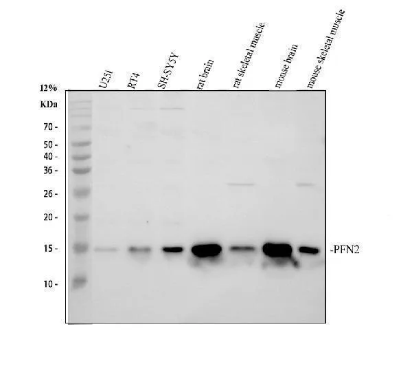Anti-Profiline 2/PFN2 Antibody Picoband®