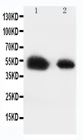 Anti-Glucose Transporter 8/SLC2A8 Antibody Picoband®