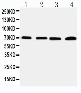 Anti-IRAK2 Antibody Picoband®