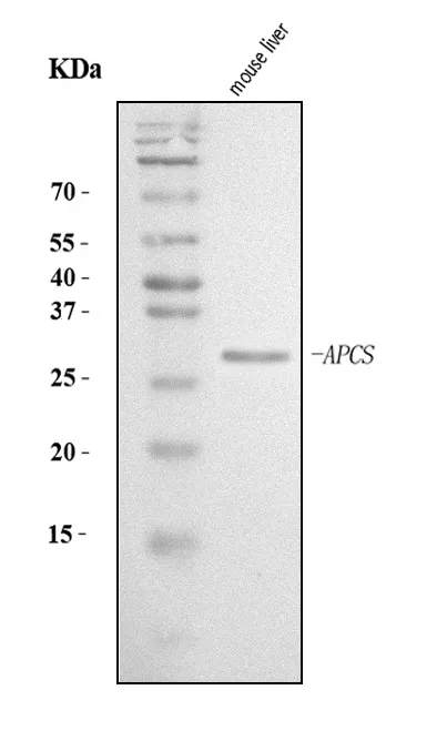 Anti-Serum amyloid P/APCS Antibody Picoband®