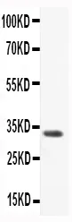 Anti-CCL3/Macrofage Inflammatory Protein 1 alpha Antibody Picoband®