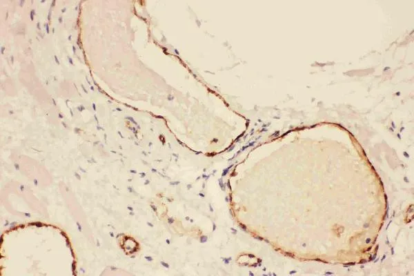Anti-Von Willebrand Factor/VWF Antibody Picoband®