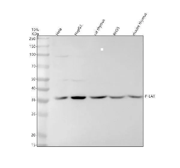 Anti-Phospho-LAT (Y191) Konijn Monoklonale Antilichaam