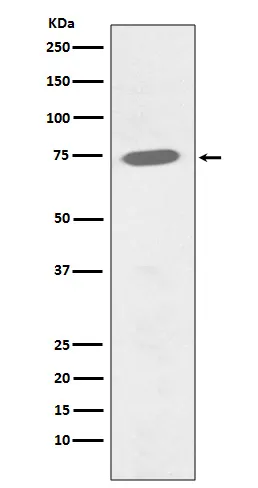 Anti-Phospho-BTK (Y551) Konijn Monoklonale Antilichaam