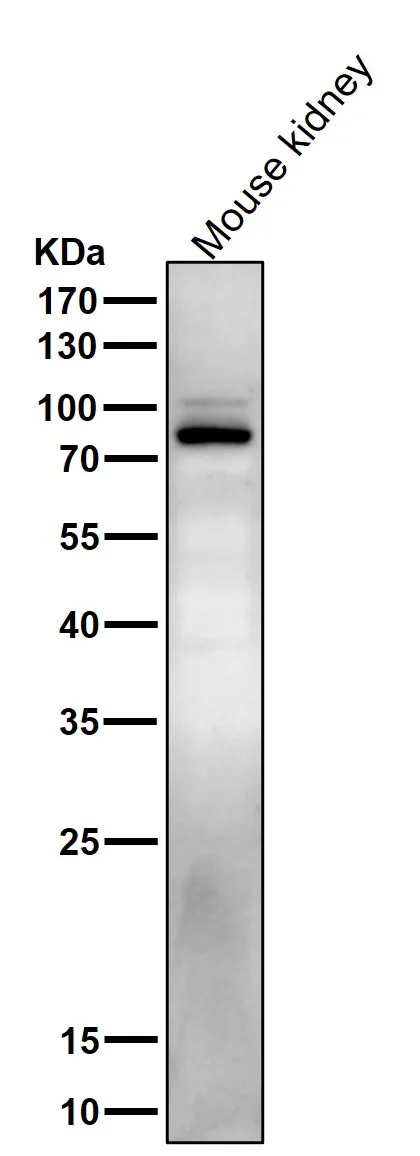 Anti-Phospho-Stat5 (Y694) STAT5A Konijn Monoklonale Antilichaam