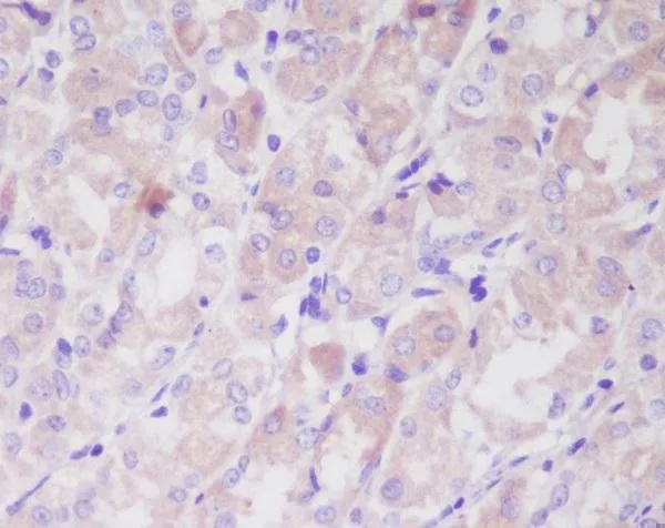 Anti-ILK/Integrin Linked Ilk Rabbit Monoclonal Antibody