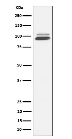 Anti-Nrf2 NFE2L2 Konijn Monoklonale Antilichaam