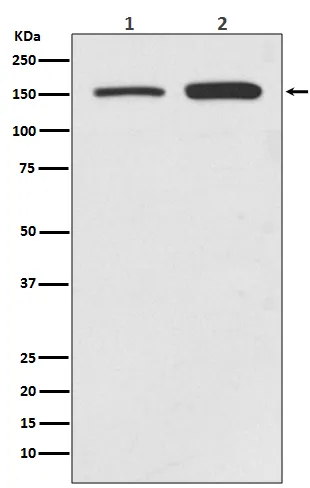 Anti-SMC1 SMC1A Konijn Monoklonale Antilichaam