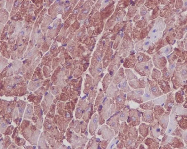 Anti-Actin ACTA1 Konijn Monoklonale Antilichaam