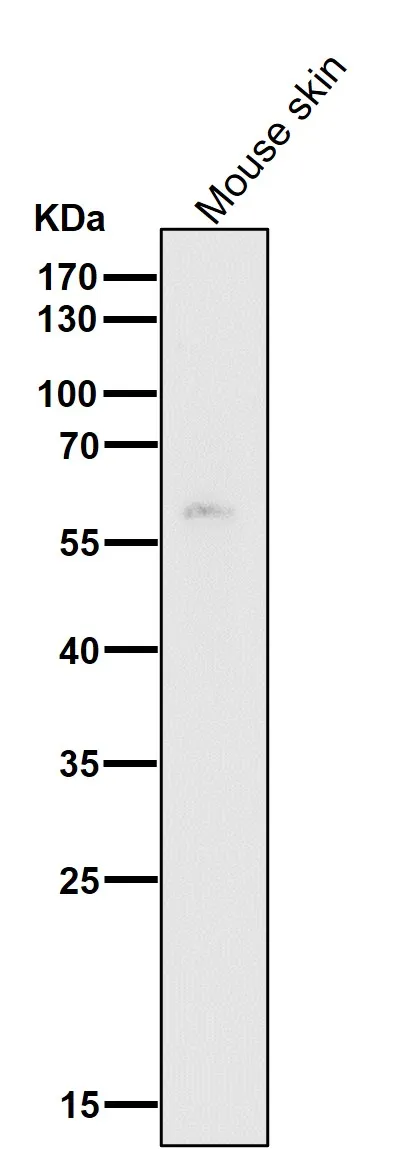 Anti-HDAC1 Konijn Monoklonale Antilichaam
