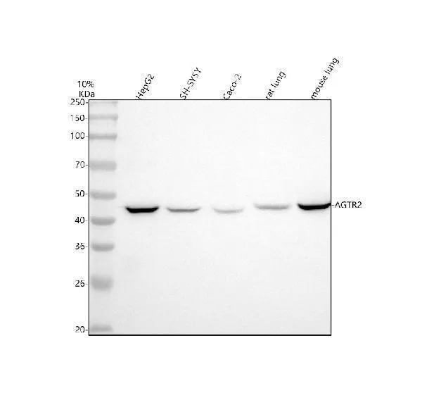 Anti-AGTR2/Angiotensine Ii Type 2 Receptor Rabbit Monoklonale Antilichaam