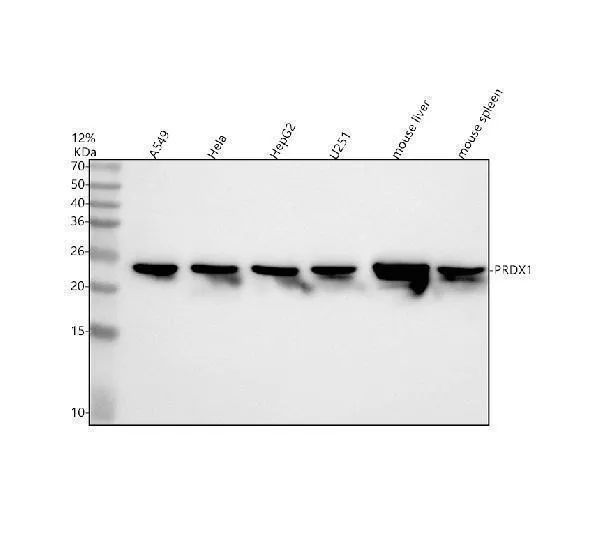 Anti-PRDX1/Peroxiredoxin 1 Konijn Monoklonale Antilichaam