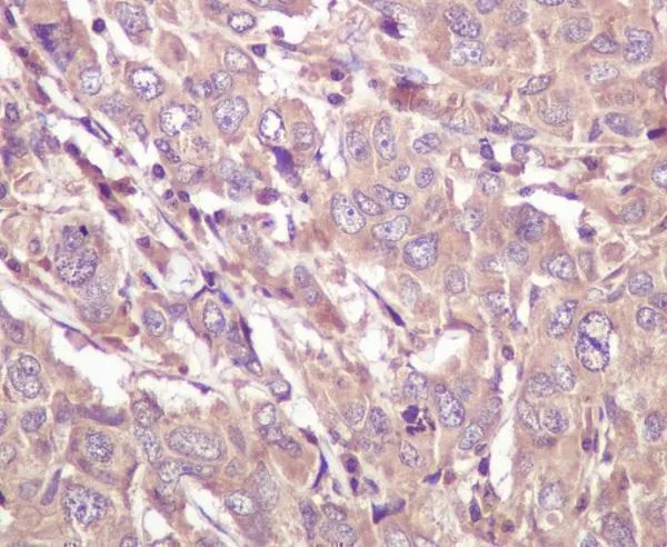 Anti-Caspase 5 CASP5 Konijn Monoklonale Antilichaam