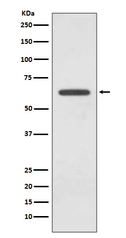 Anti-glutaminase GLS Konijn Monoklonale Antilichaam