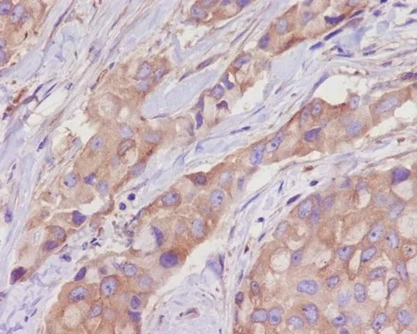 Anti-alfa Tubulin TUBA1B Konijn Monoklonale Antilichaam
