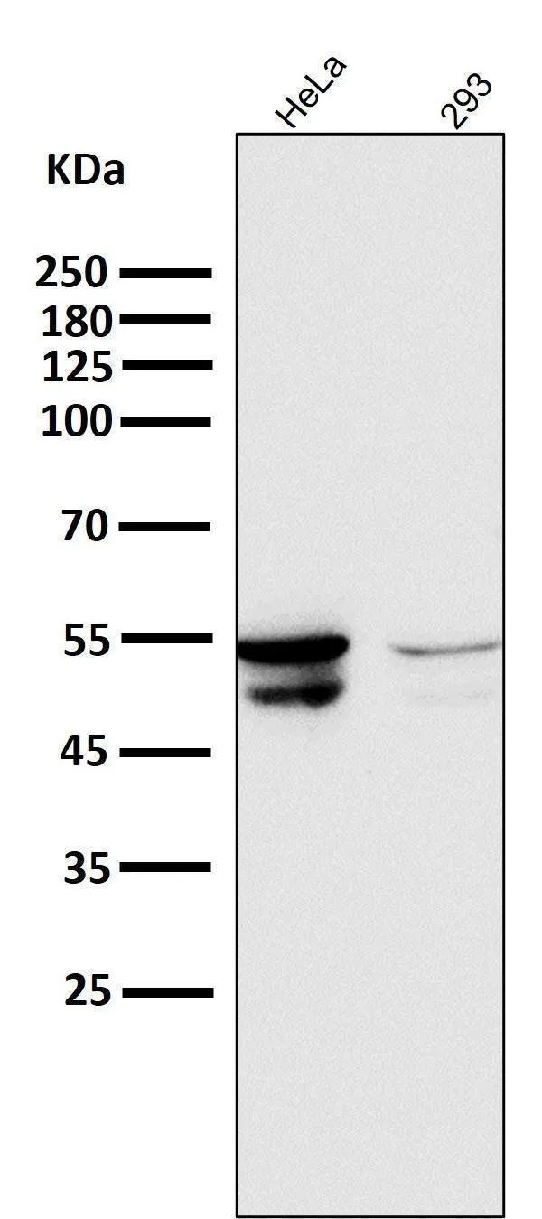 Anti-Cytokeratin 8 KRT8 Konijn Monoklonale Antilichaam