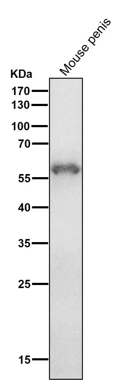 Anti-Cytokeratin 4 KRT4 Konijn Monoklonale Antilichaam