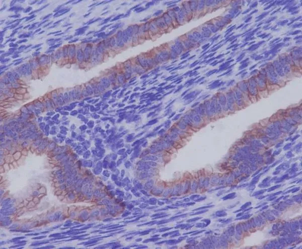 Anti-Cytokeratin 7 KRT7 Konijn Monoklonale Antilichaam