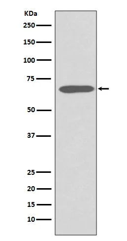 Anti-Cytokeratin 1 Konijn Monoklonale Antilichaam