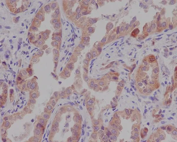 Anti-Catenin alfa 1 CTNNA1 Konijn Monoklonale Antilichaam