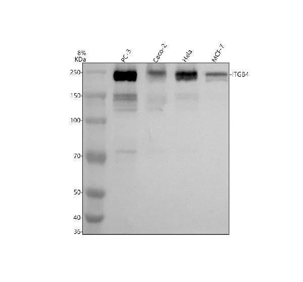 Anti-Integrin beta 4 ITGB4 Konijn Monoklonale Antilichaam