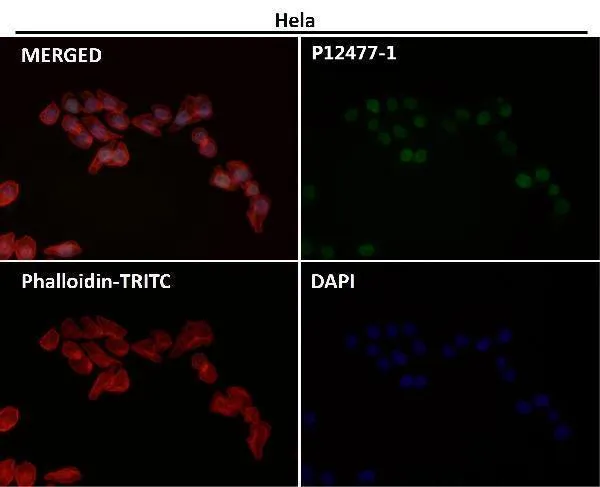 Anti-histone H3 (acetyl K56) HIST1H3A Konijn Monoklonale Antilichaam