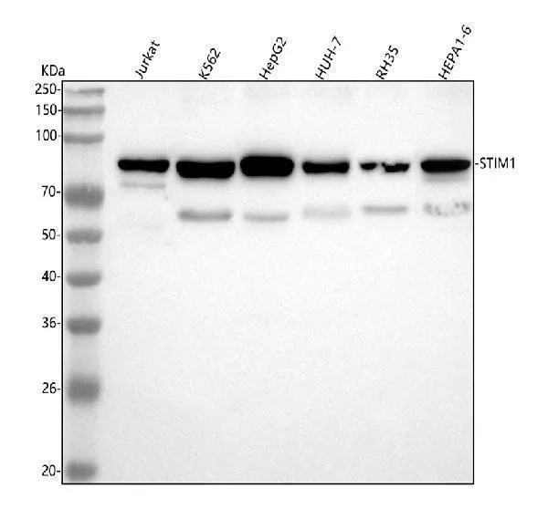 Anti-Stromale interactie molecuul 1 STIM1 Konijn Monoklonale Antilichaam