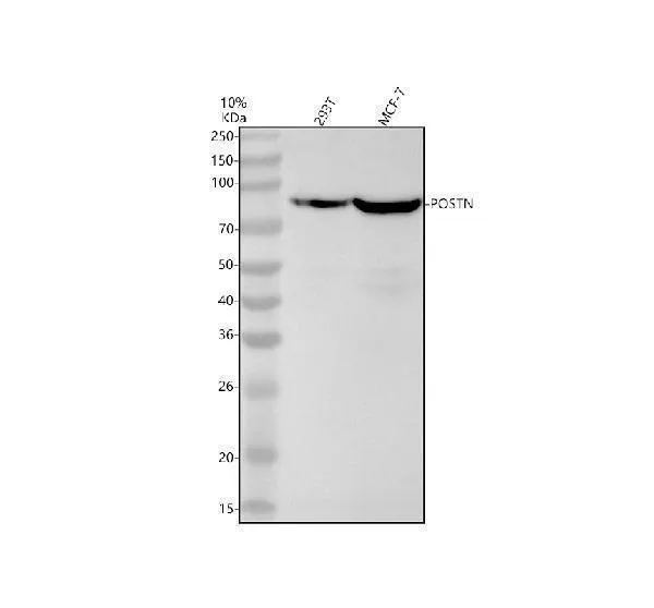 Antiperiostinemonoklonale antilichamen