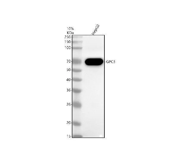 Anti-Glypican 3 Monoklonale Antilichaam