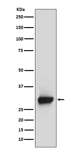 Anti-Caletinine Monoklonale Antilichaam
